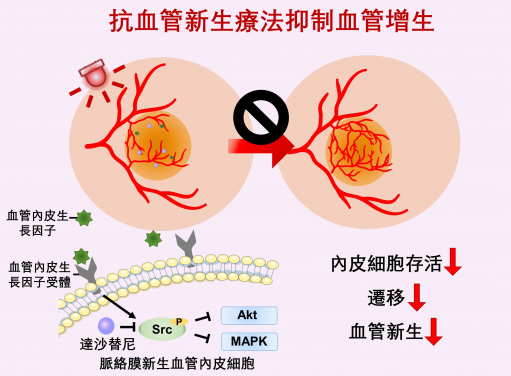 Anti-angiogenic therapy suppresses choroidal neovascularisation (CNV) by inhibiting vascular endothelial growth factor (VEGF)-related pathways. The study represents the first attempt at integrating a photoactivatable anti-angiogenic agent with a photosensitiser into a single nanoformulation for age-related macular degeneration treatment, which opens up new avenues for the development of minimally-invasive therapeutics for AMD and other neovascular ocular disorders.